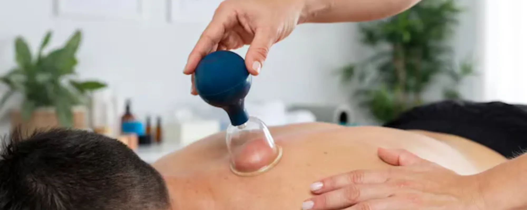 physiotherapist-performing-cupping-session-male-patient_23-2149143822 (1)
